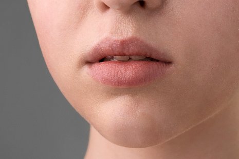 Пластика уздечки верхней губы: когда нужна операция