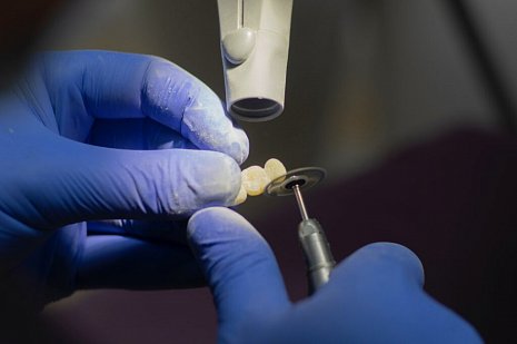 Сколько стоит коронка на жевательный зуб