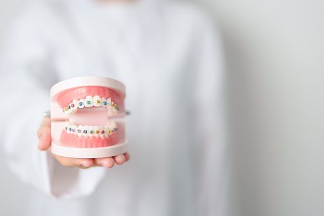 Почему могут отклеиваться брекеты и что с этим делать