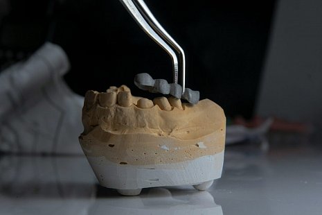 Самые лучшие и удобные зубные протезы